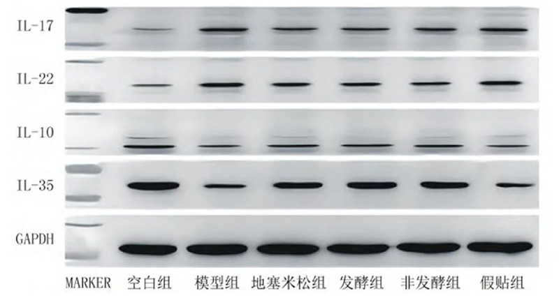 空白組和支氣管哮喘各組大鼠肺組織中IL－17、IL－22、IL－10、IL－35蛋白表達(dá)電泳圖